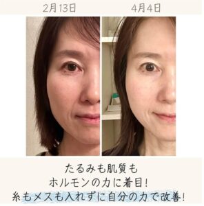 Instagram4-10
